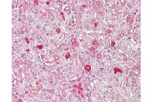 Anti-ATF1 antibody IHC of human spleen. (AFT1 抗体  (C-Term))