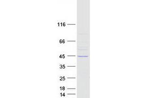 Western Blotting (WB) image for Leucine Rich Repeat Containing 28 (LRRC28) protein (Myc-DYKDDDDK Tag) (ABIN2724911)