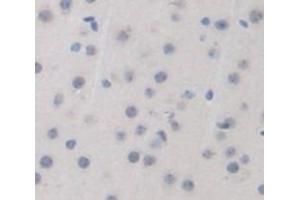 Immunohistochemistry (IHC) image for anti-Hydroxyacyl-CoA Dehydrogenase/3-Ketoacyl-CoA Thiolase/enoyl-CoA Hydratase (Trifunctional Protein), beta Subunit (HADHB) (AA 1-259) antibody (ABIN1868318)