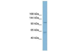 Western Blot showing CLCA2 antibody used at a concentration of 1-2 ug/ml to detect its target protein.