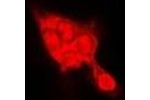 Immunofluorescent analysis of SELENBP1 staining in Hela cells. (SELENBP1 抗体)