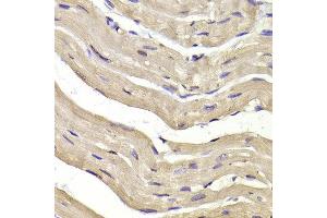 Immunohistochemistry of paraffin-embedded Mouse heart using COPS3 antibody at dilution of 1:100 (x400 lens). (COPS3 抗体)