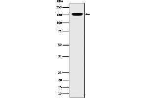 Western blot analysis of NUP155 expression in 293 cell lysate. (Recombinant NUP155 抗体)