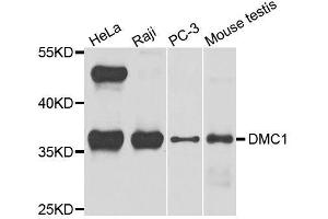 Western blot analysis of extracts of various cell lines, using DMC1 antibody. (DMC1 抗体  (AA 1-260))