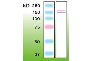 Western Blotting (WB) image for anti-Nitric Oxide Synthase 2, Inducible (NOS2) antibody (ABIN870300) (NOS2 抗体)