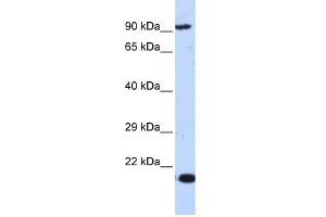 MCM7 antibody used at 1 ug/ml to detect target protein. (MCM7 抗体  (Middle Region))