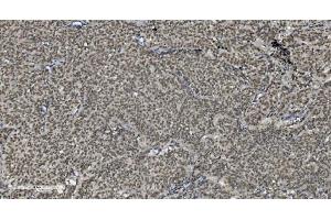 IHC analysis of U2AF65/U2AF2 using anti U2AF65/U2AF2 antibody (ABIN7600795). (U2AF2 抗体  (AA 238-470))