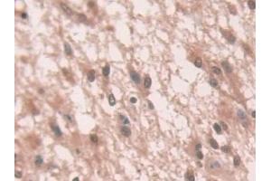 Immunohistochemistry (IHC) image for anti-NADPH Oxidase 1 (NOX1) (AA 235-488) antibody (ABIN7439315)