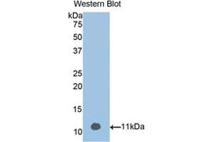 Western blot analysis of the recombinant protein. (Vitamin D-Binding Protein 抗体  (AA 395-473))