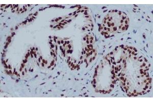 Immunohistochemistry (IHC) image for anti-Chromobox Homolog 3 (CBX3) antibody (ABIN6241538)
