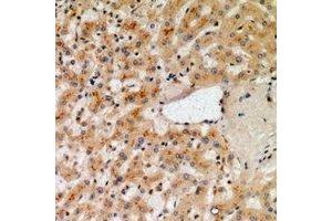 Immunohistochemical analysis of NOX1 staining in human liver formalin fixed paraffin embedded tissue section. (NOX1 抗体)
