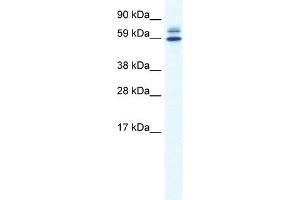 WB Suggested Anti-ZBTB38 Antibody Titration:  0. (ZBTB38 抗体  (N-Term))