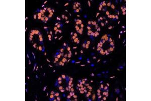Immunofluorescence (IF) image for anti-Structural Maintenance of Chromosomes 1A (SMC1A) (C-Term) antibody (ABIN7455193)