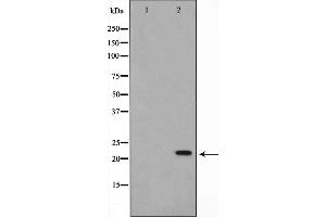 Western blot analysis on Jurkat cell lysate using AKAP14 Antibody,The lane on the left is treated with the antigen-specific peptide. (AKAP14 抗体  (N-Term))
