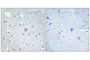 Immunohistochemistry analysis of paraffin-embedded human brain tissue using CTRO antibody. (CIT 抗体)
