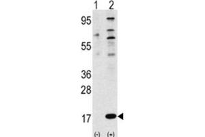 Western Blotting (WB) image for anti-Finkel-Biskis-Reilly Murine Sarcoma Virus (FBR-MuSV) Ubiquitously Expressed (FAU) antibody (ABIN2998455) (FAU 抗体)