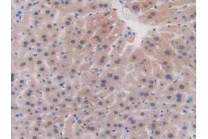 Detection of FBN1 in Mouse Liver Tissue using Polyclonal Antibody to Fibrillin 1 (FBN1) (Fibrillin 1 抗体  (AA 959-1145))