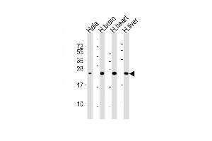 All lanes : Anti-SD Antibody at 1:2000 dilution Lane 1: Hela whole cell lysates Lane 2: human brain lysates Lane 3: human heart lysates Lane 4: human liver lysates Lysates/proteins at 20 μg per lane. (SOD2 抗体)