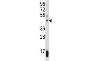 SUV39H1 antibody western blot analysis in 293 lysate. (SUV39H1 抗体  (AA 79-108))