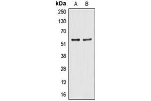 Western blot analysis of ALDH2 expression in HegG2 (A), A549 (B) whole cell lysates. (ALDH2 抗体  (N-Term))