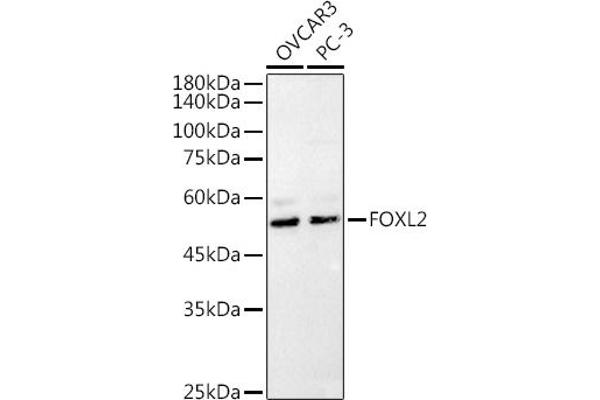 FOXL2 抗体  (C-Term)