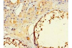 Immunohistochemistry (IHC) image for anti-MORC Family CW-Type Zinc Finger 1 (MORC1) (AA 683-984) antibody (ABIN7160194)