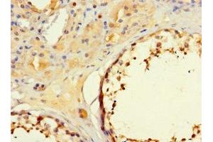 Immunohistochemistry of paraffin-embedded human testis tissue using ABIN7160194 at dilution of 1:100 (MORC1 抗体  (AA 683-984))