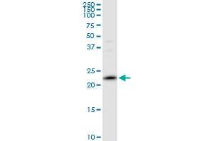 PRDX2 MaxPab polyclonal antibody. (Peroxiredoxin 2 抗体  (AA 1-198))