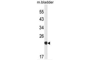 Western blot analysis of CLDN23 Antibody (C-term) in mouse bladder tissue lysates (35µg/lane). (Claudin 23 抗体  (C-Term))