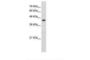 Image no. 1 for anti-Ring Finger Protein 32 (RNF32) (AA 151-200) antibody (ABIN203533) (RNF32 抗体  (AA 151-200))