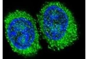 Confocal immunofluorescent analysis of NPC1 antibody with 293 cells followed by Alexa Fluor 488-conjugated goat anti-rabbit lgG (green). (NPC1 抗体  (AA 591-620))