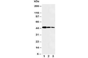 Western blot testing with MYBL2 antibody and recombinant protein, 47KD with tag;  Lane 1: Recombinant protein at 10ng;  2: 5ng;  3: 2.