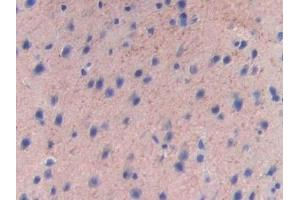 Immunohistochemistry (IHC) image for anti-Coagulation Factor V (F5) (AA 1776-2028) antibody (ABIN7438928)