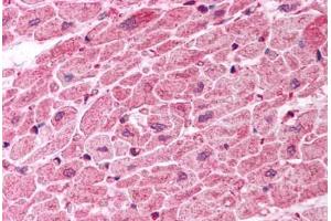 Human Heart (formalin-fixed, paraffin-embedded) stained with TICAM1 antibody ABIN457458 at 10 ug/ml followed by biotinylated goat anti-rabbit IgG secondary antibody ABIN481713, alkaline phosphatase-streptavidin and chromogen. (TICAM1 抗体  (C-Term))