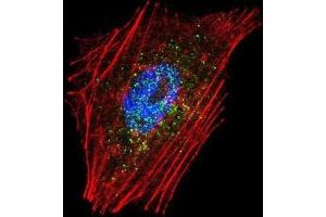 Immunofluorescence (IF) image for anti-Parkinson Protein 2, E3 Ubiquitin Protein Ligase (Parkin) (PARK2) antibody (ABIN3002635) (Parkin 抗体)