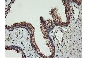 Image no. 8 for anti-V-Akt Murine Thymoma Viral Oncogene Homolog 1 (AKT1) antibody (ABIN1496554) (AKT1 抗体)