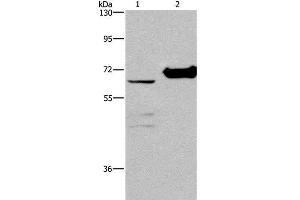 Western Blot analysis of 231 cell and Mouse kidney tissue using CHDH Polyclonal Antibody at dilution of 1:400 (CHDH 抗体)