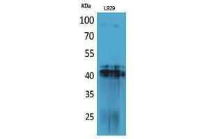 Western Blotting (WB) image for anti-Platelet Derived Growth Factor D (PDGFD) (C-Term) antibody (ABIN3187818) (PDGFD 抗体  (C-Term))