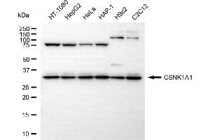 Western blotting analysis using CSNK1A1 antibody (ABIN7797880).