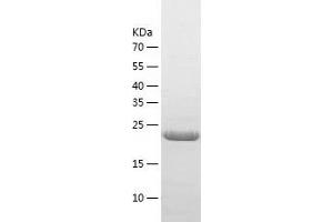 TIGD5 Protein (AA 32-248) (His tag)