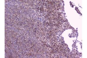 IHC analysis of PBP using anti-PBP antibody (ABIN5693043). (PEBP1 抗体)