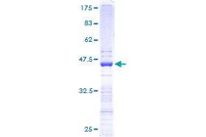 Image no. 1 for Ribosomal Protein S19 (RPS19) (AA 1-145) protein (GST tag) (ABIN1318760) (RPS19 Protein (AA 1-145) (GST tag))