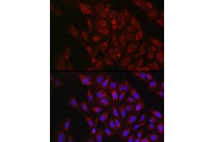 Immunofluorescence (IF) image for anti-RanBP-Type and C3HC4-Type Zinc Finger Containing 1 (RBCK1) antibody (ABIN7269848)