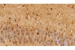 Immunohistochemistry (IHC) image for anti-Glyceraldehyde-3-Phosphate Dehydrogenase (GAPDH) (AA 2-148) antibody (ABIN7428953)