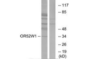Western blot analysis of extracts from HeLa cells, using OR52W1 Antibody. (OR52W1 抗体  (AA 271-320))