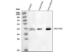 Western blot analysis of HSD11B2 using anti-HSD11B2 antibody (ABIN3043846).
