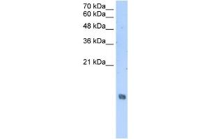 HIST2H2AA3 antibody used at 2. (HIST2H2AA3 抗体  (Middle Region))