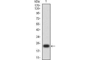 Western blot analysis using HIF2a mAb against human HIF2a (AA: 680-870) recombinant protein. (EPAS1 抗体  (AA 680-870))