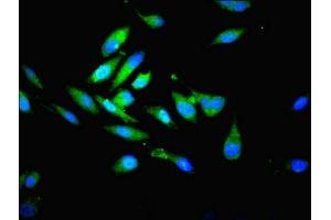 Immunofluorescence (IF) image for anti-Proteasome (Prosome, Macropain) Subunit, beta Type, 7 (PSMB7) (AA 44-275) antibody (ABIN7164986)
