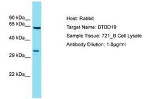 Image no. 1 for anti-BTB (POZ) Domain Containing 19 (BTBD19) (AA 208-257) antibody (ABIN6750766) (BTBD19 抗体  (AA 208-257))